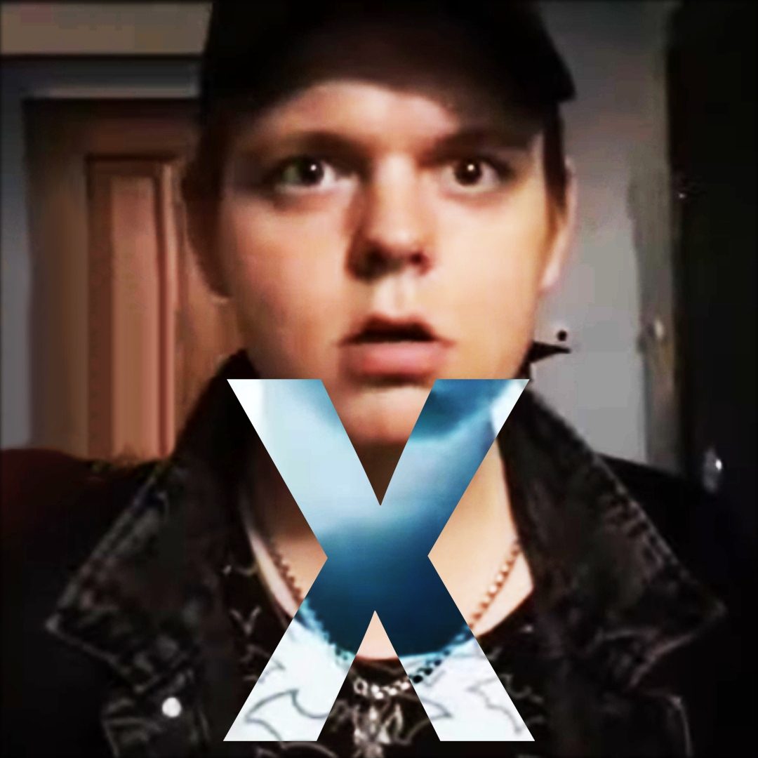XRAY